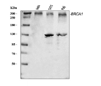 Anti-BRCA1 Antibody