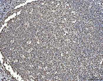 Anti-BRCA1 Antibody