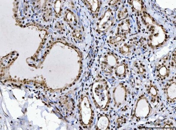 Anti-BRCA1 Antibody