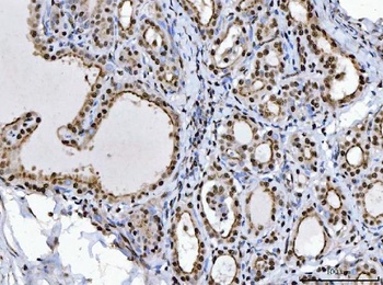 BRCA1 Antibody