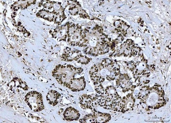 Anti-BRCA1 Antibody