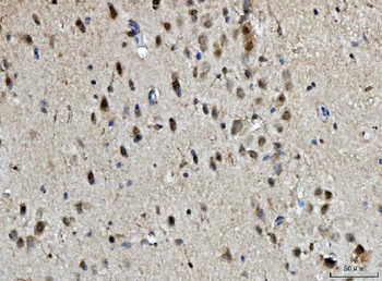 Anti-BRCA1 Antibody