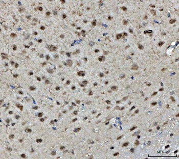 Anti-BRCA1 Antibody