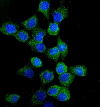 Anti-EGFR Antibody