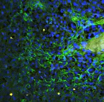 Anti-ICAM1 Antibody
