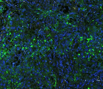 ICAM1 Antibody