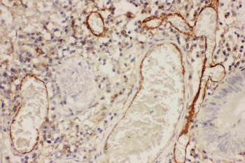 Anti-ICAM1 Antibody