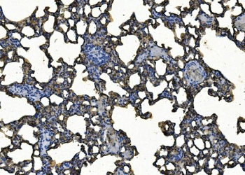 ICAM1 Antibody