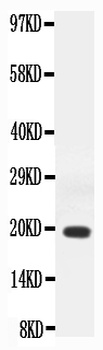 Interferon gamma/IFNG Rabbit Polyclonal Antibody