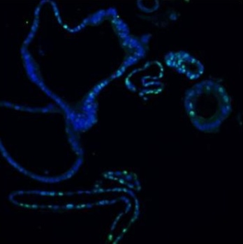 Anti-Ki67/MKI67 Antibody