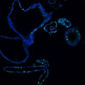 Ki67/MKI67 Antibody