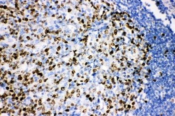 Anti-Ki67/MKI67 Antibody