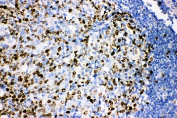 Ki67/MKI67 Antibody