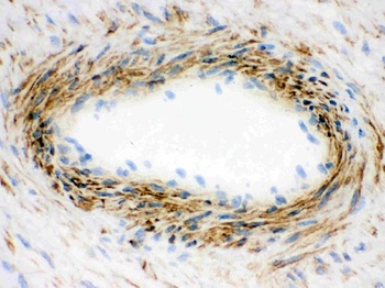 Anti-Actin ACTA1 Antibody (Monoclonal, AC-40)