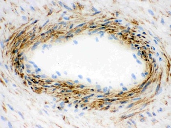 Actin ACTA1 Antibody (Monoclonal, AC-40)