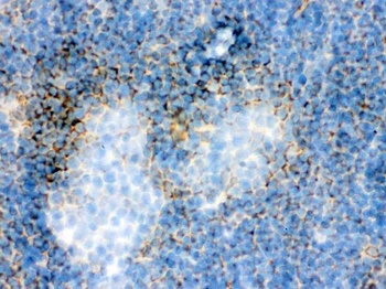 Anti-Actin ACTA1 Antibody (Monoclonal, AC-40)