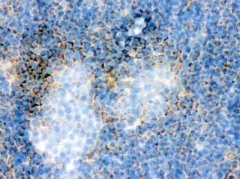 Actin ACTA1 Antibody (Monoclonal, AC-40)