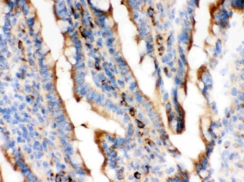 Anti-Actin ACTA1 Antibody (Monoclonal, AC-40)