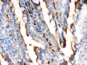 Actin ACTA1 Antibody (Monoclonal, AC-40)