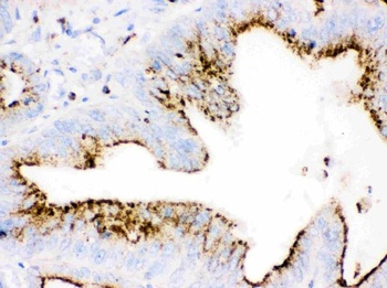 Anti-Cathepsin D Ctsd Monoclonal Antibody