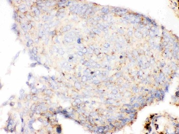 Anti-Cathepsin D Ctsd Monoclonal Antibody