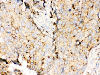 Anti-Cathepsin D Ctsd Monoclonal Antibody