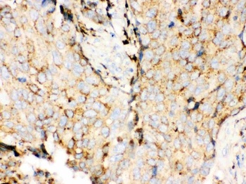 Cathepsin D Ctsd Monoclonal Antibody