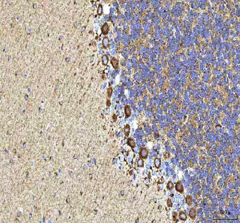 Anti-HCRT Antibody