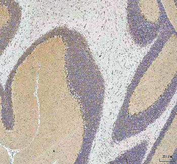 Anti-HCRT Antibody