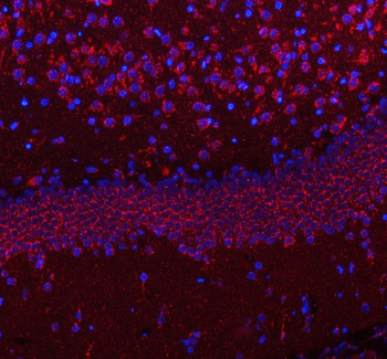 Anti-HCRT Antibody