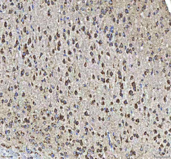 Anti-HCRT Antibody