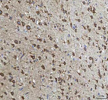 Anti-HCRT Antibody