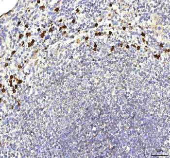 Anti-S100A12 Antibody