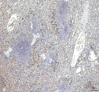 Anti-S100A12 Antibody