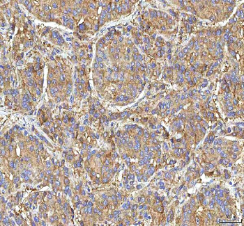 Anti-GOLGA7 Antibody