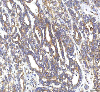 Anti-GOLGA7 Antibody