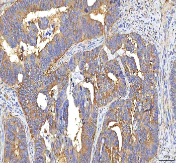 Anti-GOLGA7 Antibody