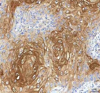 Anti-GOLGA7 Antibody