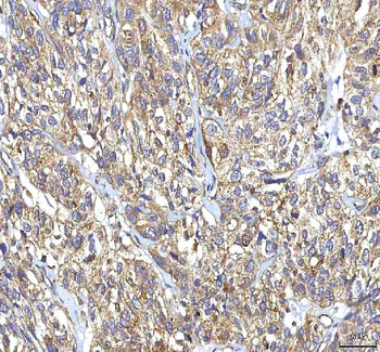 Anti-GOLGA7 Antibody