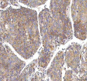 Anti-OCM Antibody
