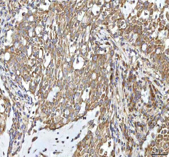 Anti-OCM Antibody