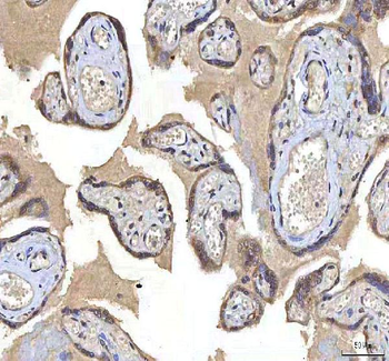 Anti-OCM Antibody