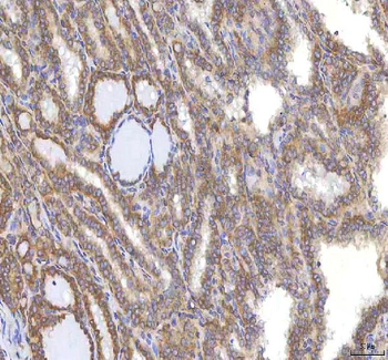 Anti-OCM Antibody
