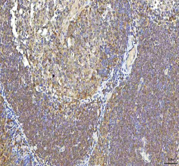 Anti-OCM Antibody