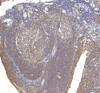 Anti-OCM Antibody