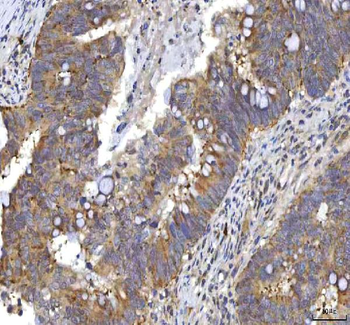 Anti-RASGRP3 Antibody
