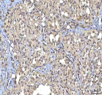 Anti-RASGRP3 Antibody