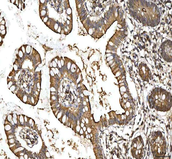 SMIM8 Antibody