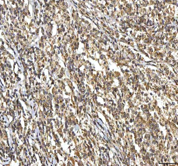 Anti-SMIM8 Antibody