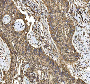 Anti-SMIM8 Antibody